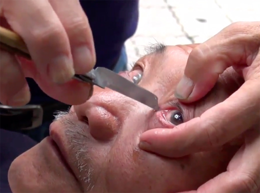 Eyeball c
